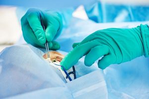 Eye Diseases